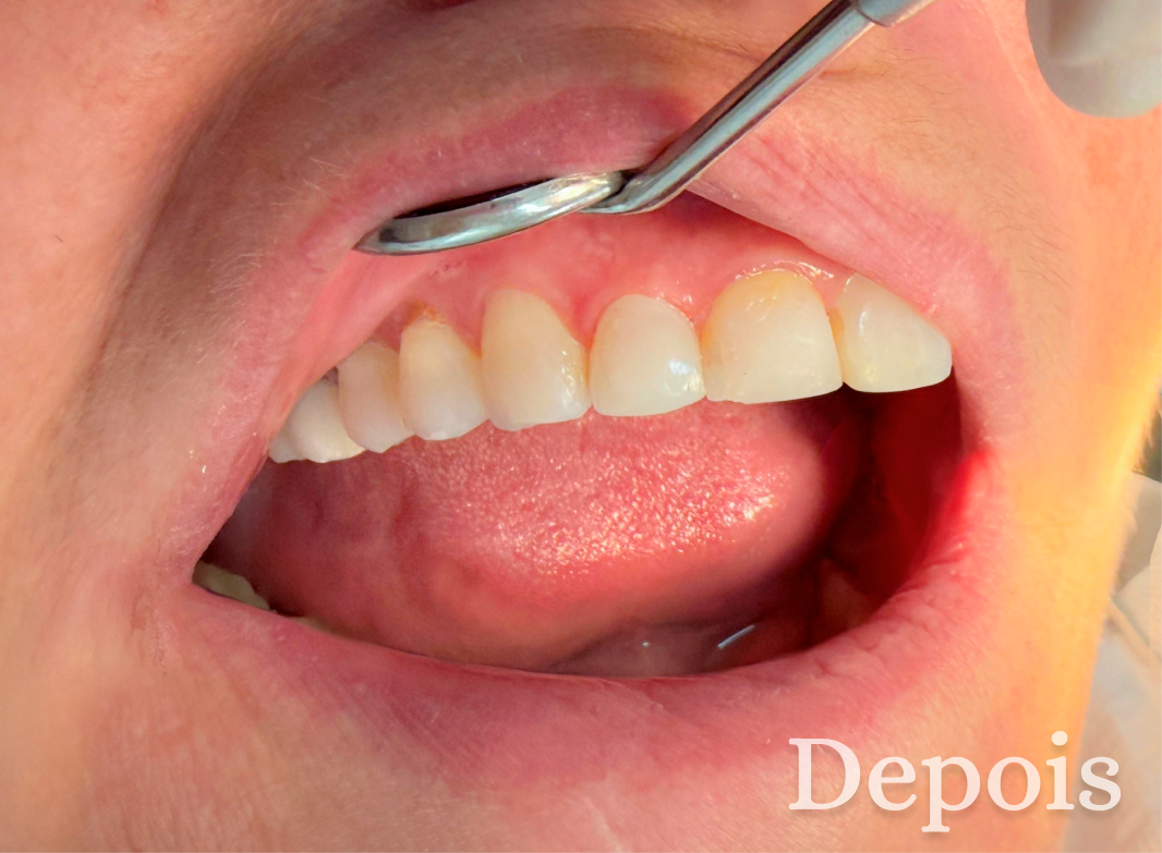 Dra. Vanessa Kikuchi – Odontologia em Bragança Paulista e Região