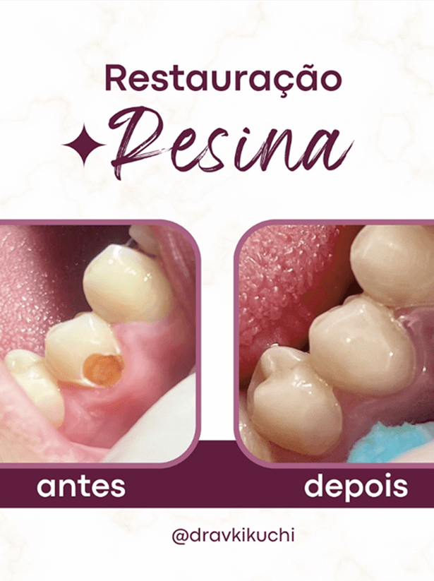 Dra. Vanessa Kikuchi – Odontologia em Bragança Paulista e Região