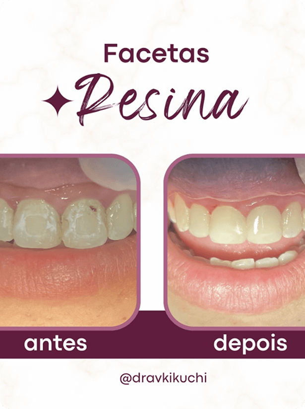 Dra. Vanessa Kikuchi – Odontologia em Bragança Paulista e Região