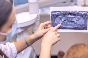 Implante Dentário em Bragança Paulista | Dra. Vanessa Kikuchi