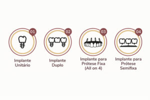 Implante Dentário em Bragança Paulista | Dra. Vanessa Kikuchi
