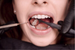 Implante Dentário em Bragança Paulista | Dra. Vanessa Kikuchi